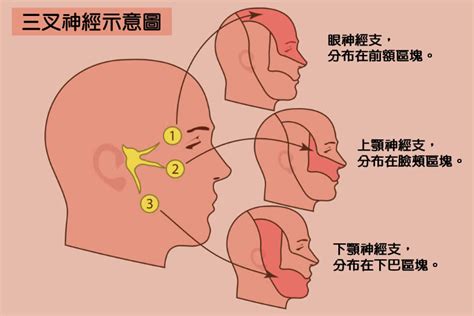 左邊臉痛|三叉神經痛 / 面部痛症 / 牙骹痛